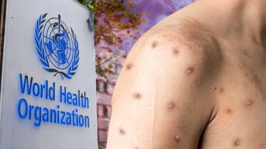 İki Yıl İçinde İkinci Kez! DSÖ’den Küresel Çağrı 